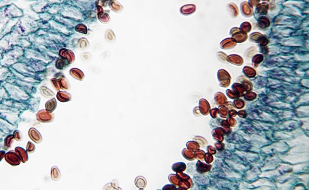 Microscopic view of mushroom spores used in fungal reproduction